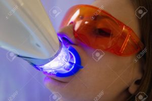 Dr. Kuhn providing cosmetic teeth whitening treatment in Westminster Carroll County MD