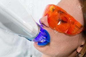Dr. Kuhn providing cosmetic teeth whitening treatment in Westminster Carroll County MD