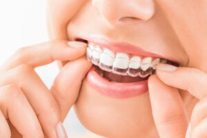 Clear aligner treatment with Invisalign provider in Westminster Carroll County Maryland