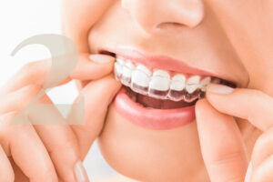 Invisalign clear aligners at Gallagher & Kuhn Dental Group, Westminster, Carroll County, MD