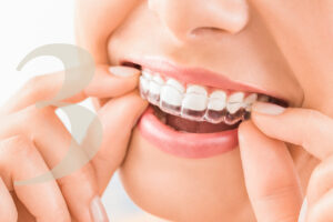 Invisalign clear aligners at Gallagher & Kuhn Dental Group, Westminster, Carroll County, MD